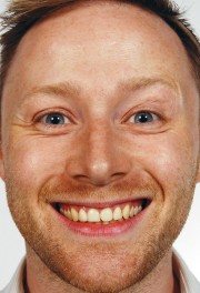 watch Limmy's Show free online